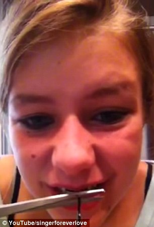 Last resort: The young people creating the videos often claim they are doing so because their family cannot afford to get them braces