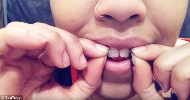 Trying it at home: The popularity of the practice has led the American Association of Orthodontists to issue a warning against the use of elastics on teeth